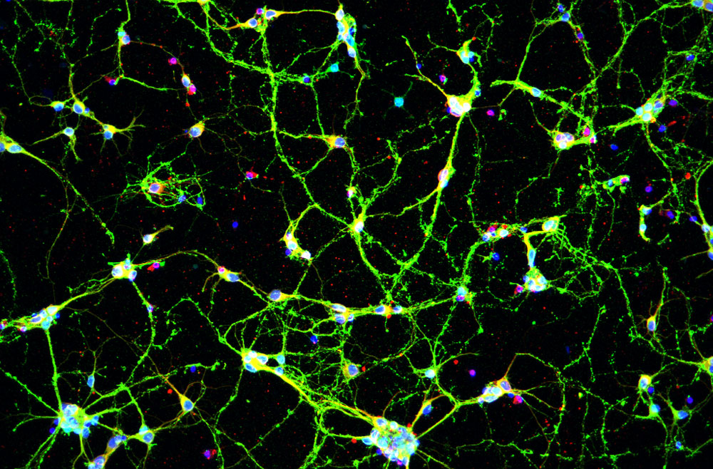 Neurons and synapses